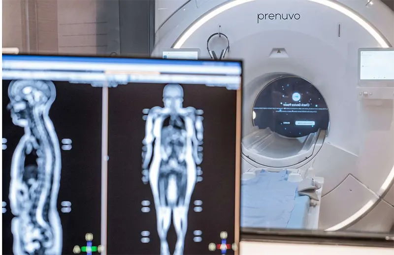 Full Body MRI Imaging Analysis