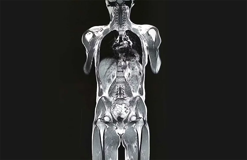 Non-Invasive Imaging with